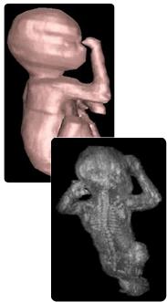 3D Ultrasound images