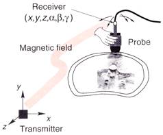 Configuration of freehand ultrasound