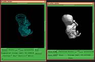 3D Fetus