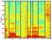 image of speech spectogram