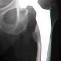 X-ray image